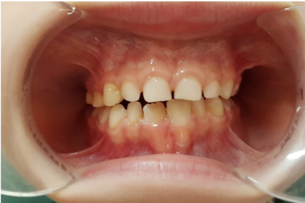 Estética dental en Las Rozas - Centro dental Heron
